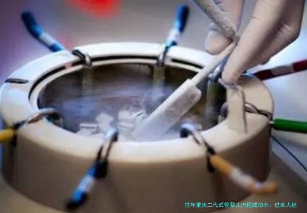 往年重庆二代试管婴儿流程成功率：过来人经验与真实数据分享