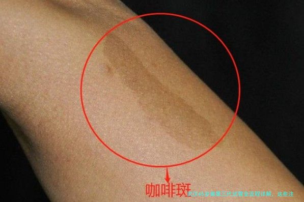 武汉45岁做第三代试管全流程详解,这些注意事项别忽略