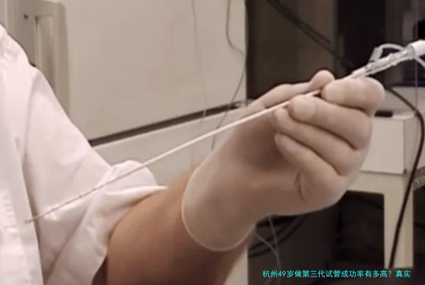 杭州49岁做第三代试管成功率有多高？真实流程与风险一文说清