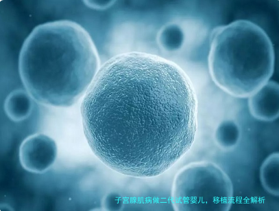 子宫腺肌病做二代试管婴儿,移植流程全解析