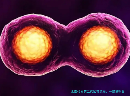 北京45岁第二代试管流程，一篇说明白