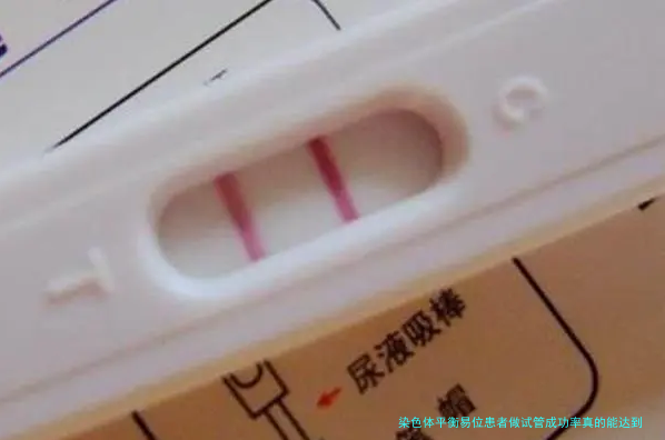 染色体平衡易位患者做试管成功率真的能达到80%以上吗？