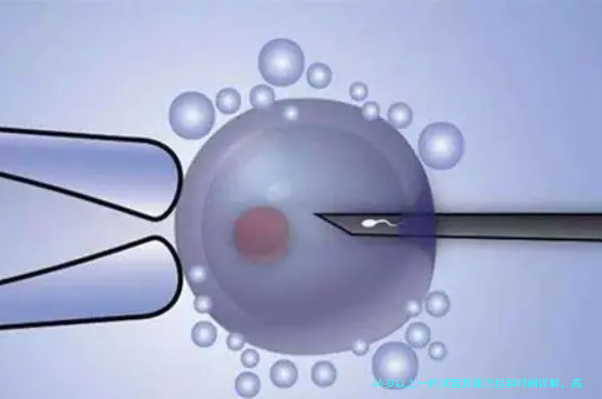 45岁以上一代试管具体流程和时间详解，高龄备孕别错过！