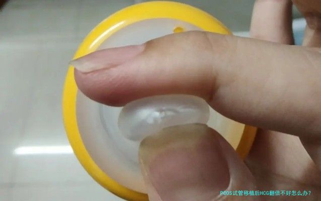 PCOS试管移植后HCG翻倍不好怎么办？先别自己吓自己
