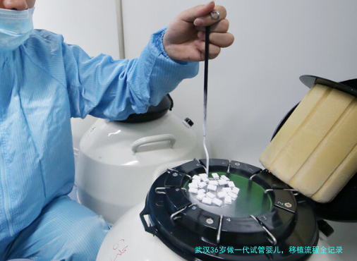 武汉36岁做一代试管婴儿，移植流程全记录，少走弯路