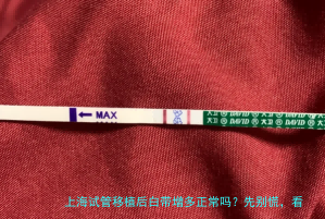 上海试管移植后白带增多正常吗？先别慌，看这里