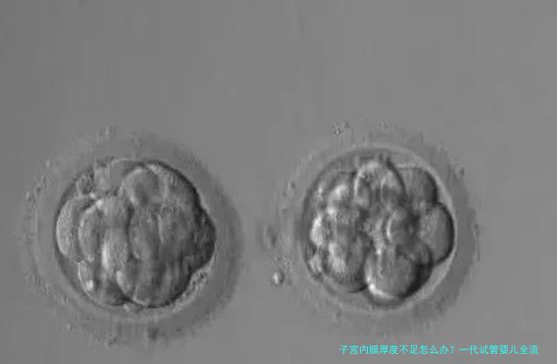 子宫内膜厚度不足怎么办？一代试管婴儿全流程详解