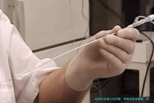 杭州42岁做三代试管，移植流程全解析，高龄姐妹看这篇就够