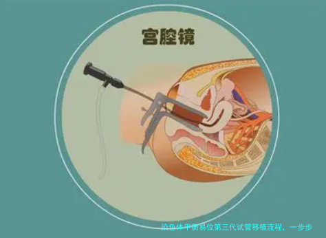 染色体平衡易位第三代试管移植流程，一步步给你讲清楚