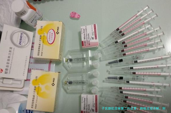 子宫腺肌症做第二代试管，移植流程详解，别自己吓自己