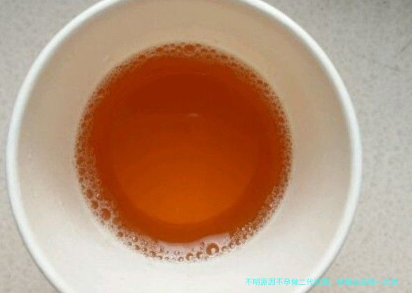 不明原因不孕做二代试管，移植全流程一文讲透