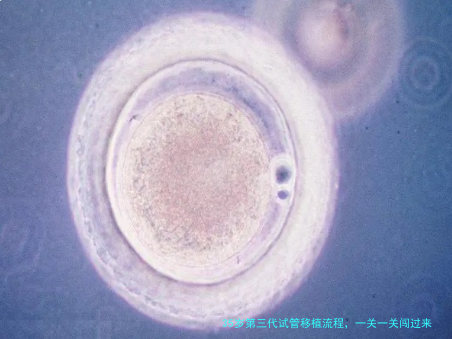 35岁第三代试管移植流程,一关一关闯过来