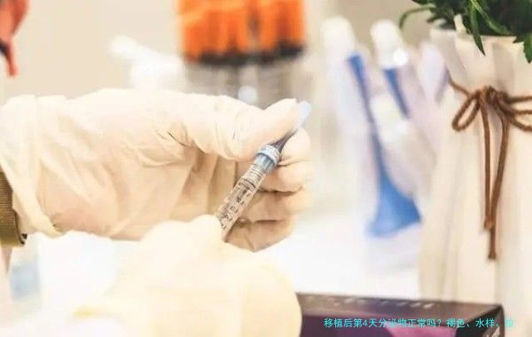 移植后第4天分泌物正常吗?褐色、水样、拉丝,一文讲清