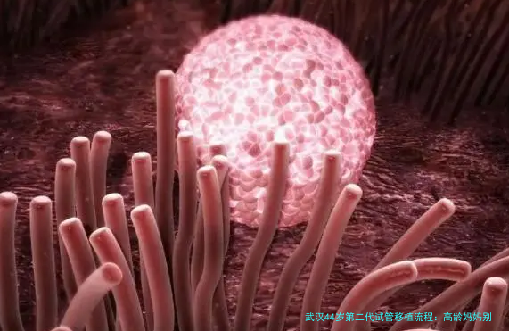 武汉44岁第二代试管移植流程：高龄妈妈别只盯着移植那一步