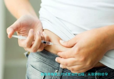 胚胎移植第二代试管治疗过程：从取卵到验孕的完整流程