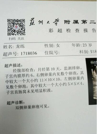卵泡的检测