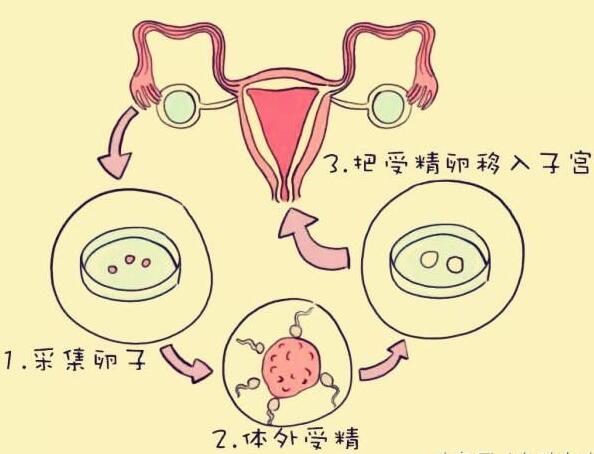 试管婴儿流程图