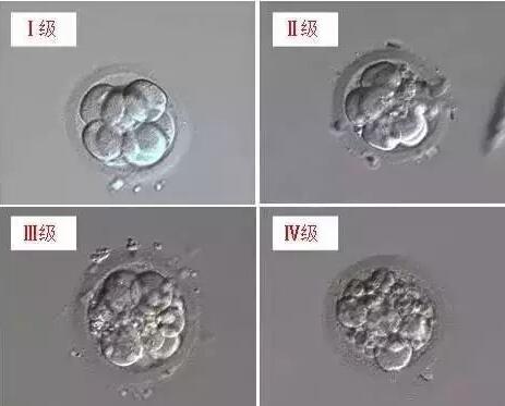 试管婴儿胚胎分级标准