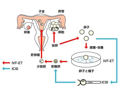 试管婴儿流程