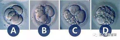 试管婴儿胚胎等级