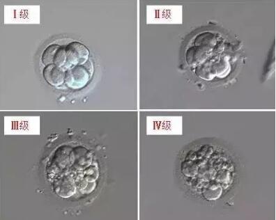 试管婴儿的胚胎是如何评级的